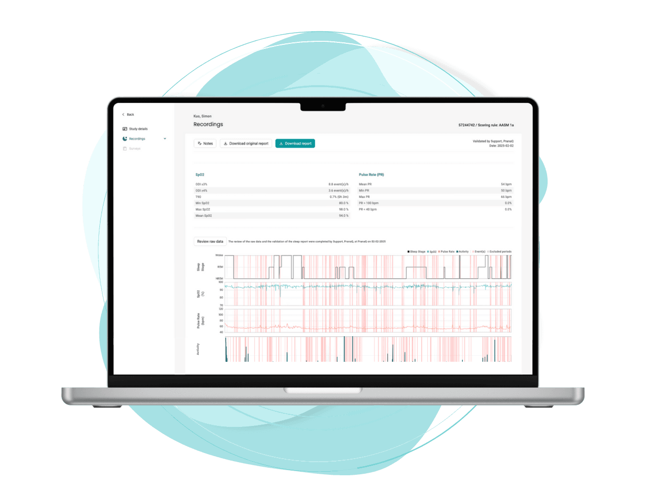 Homekit recording view with SpO2, pulse rate and sleep-stage traces